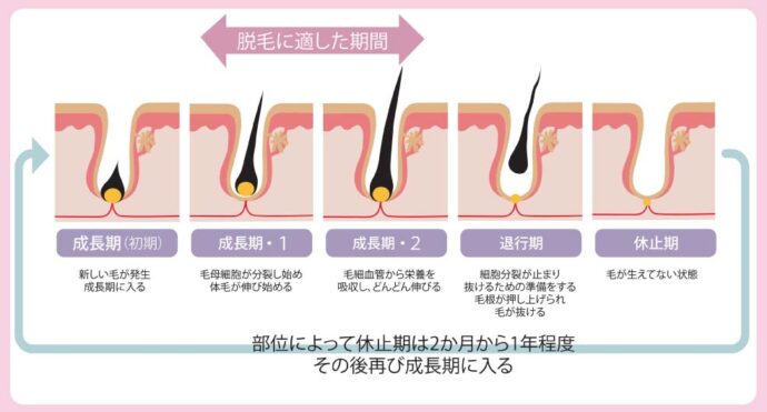 毛周期と脱毛の関係